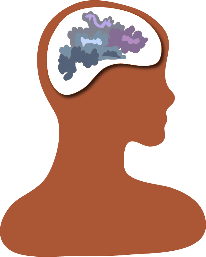 Brain fog by Susan Fluegel